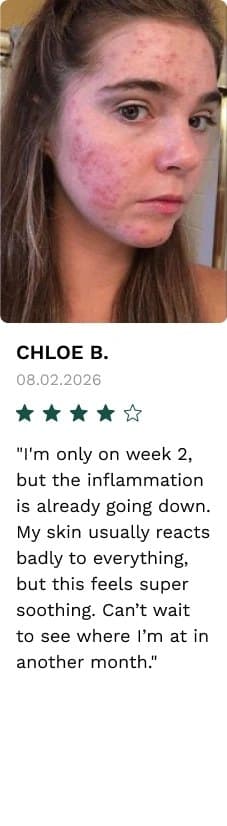 Review by Chloe B.