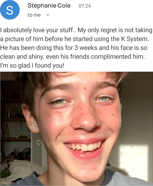 Stephanie Cole Review - Son's face clean and shiny after 3 weeks of K System