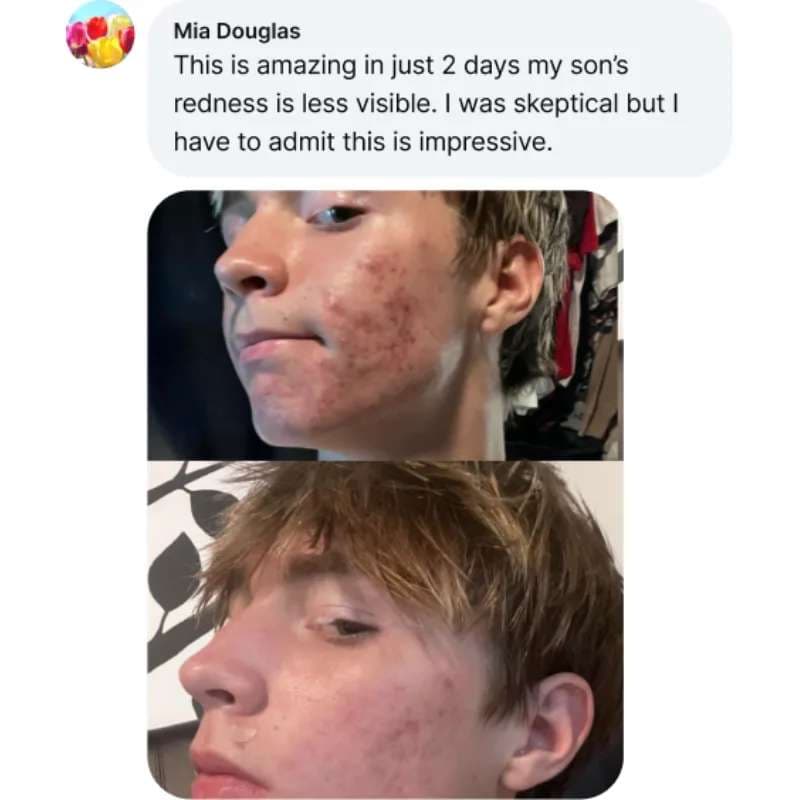 Recent Transformation 4