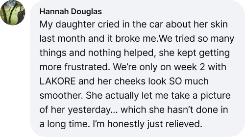 Hannah Douglas Review - Daughter's cheeks smoother on week 2 with LAKORE